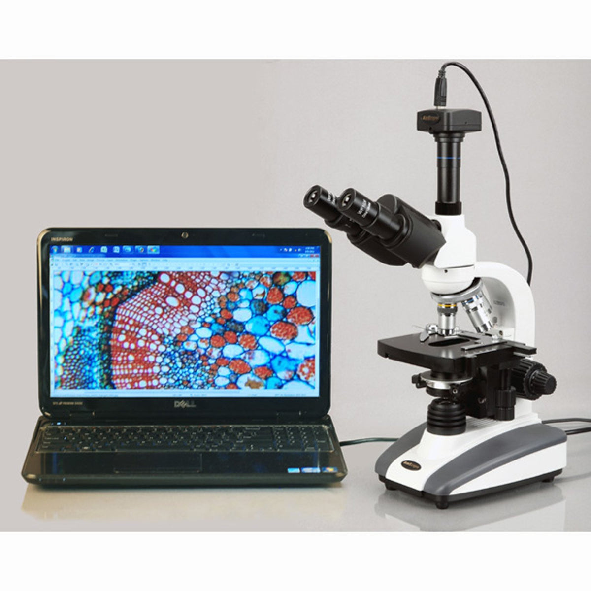AmScope Abbe condenser with diaphragm enhances contrast and detail.