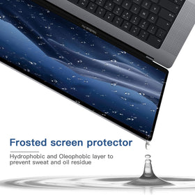 ANTOGOO V MacBook Pro 15 residue-free removal leaves no sticky mess.