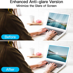 ANTOGOO V UV protection layer helps preserve screen clarity over time
