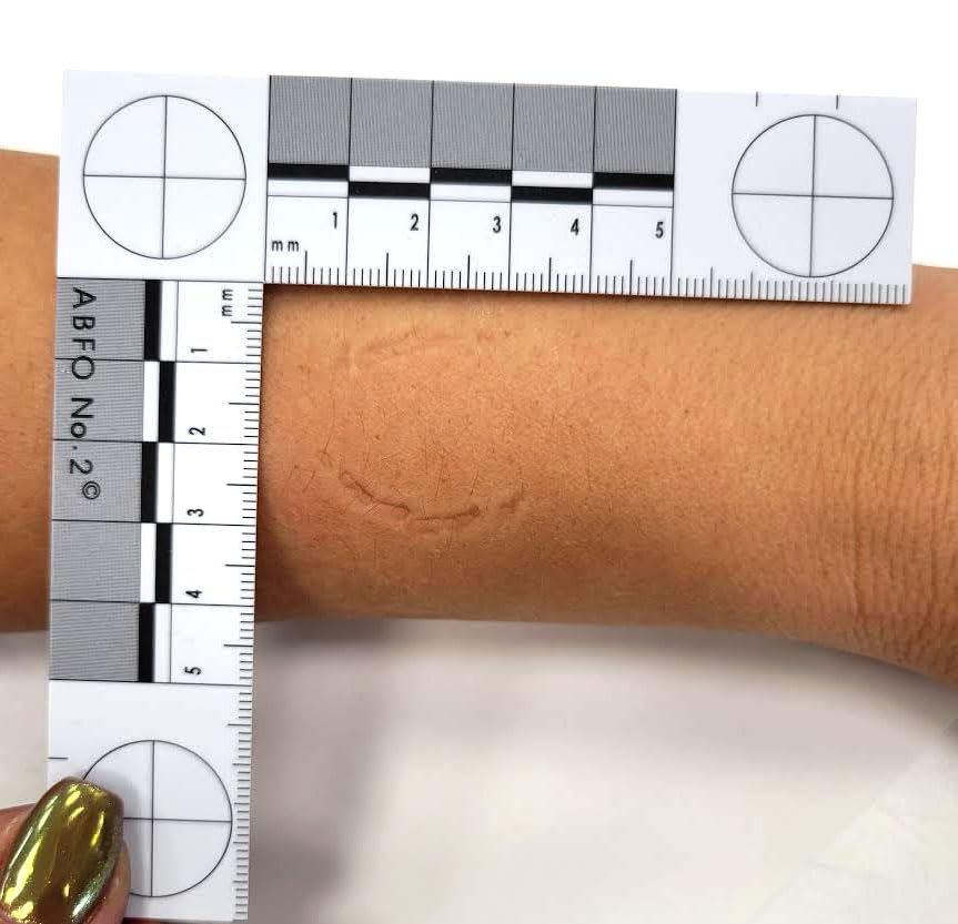 Crime Scene scale placed next to evidence in use showing tonal reference and measurement benefit