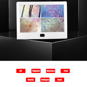 FOKH Scalp Detector 13-inch display shows clear skin and hair imagery.