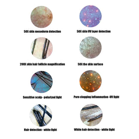 FOKH Scalp Detector image storage supports before/after comparisons.