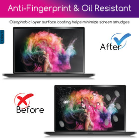 KEANBOLL IdeaPad 5 14 edge-to-edge coverage in use.