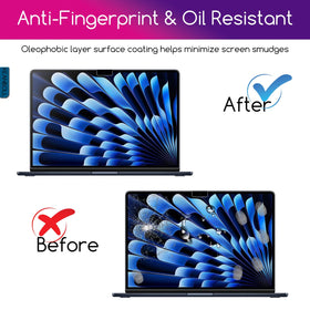 KEANBOLL scratch-resistant surface keeps your MacBook screen looking new.
