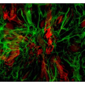 OMAX software with stitching and EDF enables advanced imaging workflows