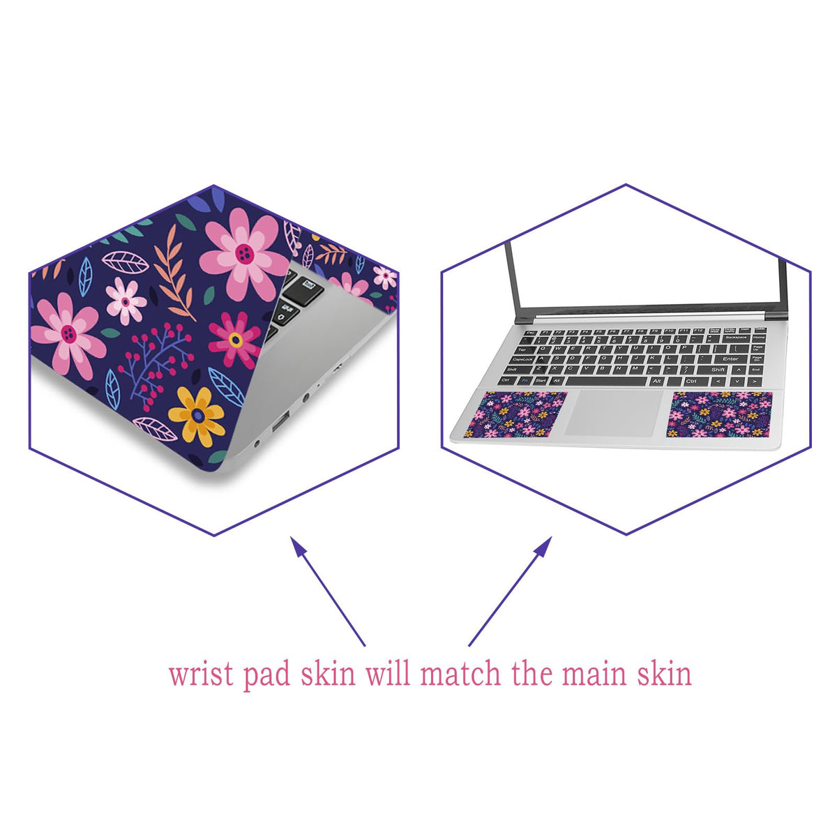 ToLuLu flower-theme back cover skin guards against scratches and dust with bold look.
